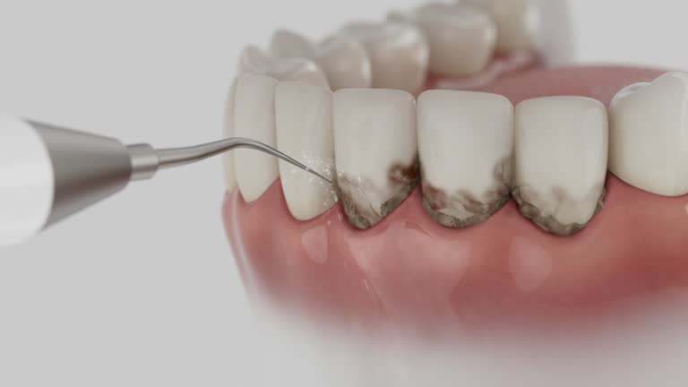 Reliable Emergency Dentist contractor in Marion, OH by Smile Center Dentistry